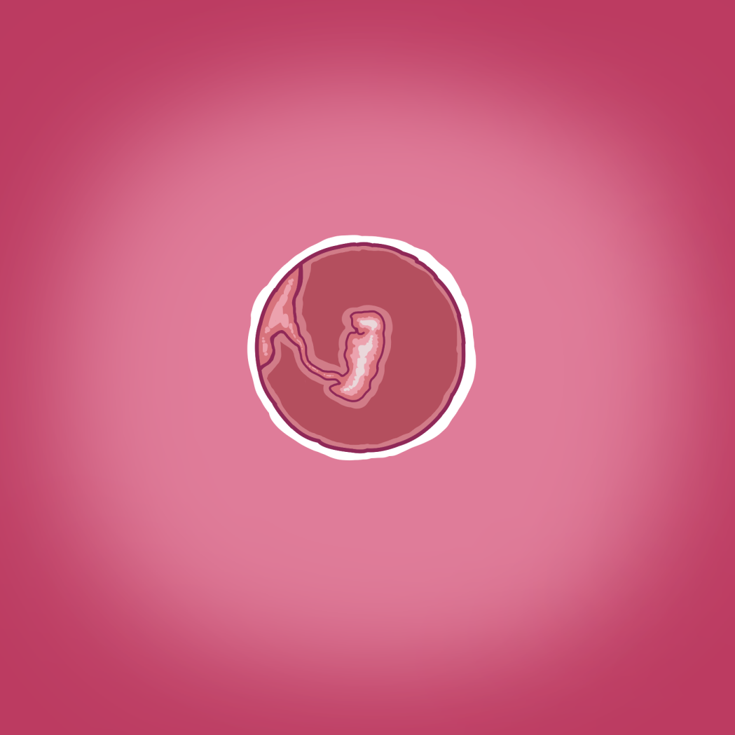 Yumi's Study Abroad/由美的留学生活（汉化）（连载中） - Page 4